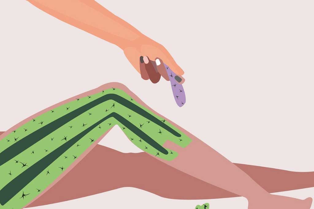 lazer-epilasyonun-avantajlari_1x